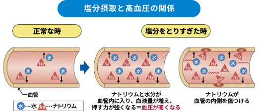 血管の専門医が初めて明かす減塩の秘策 置き換えるだけ この秋から肉食で減塩生活 お肉ステーション エバラ食品